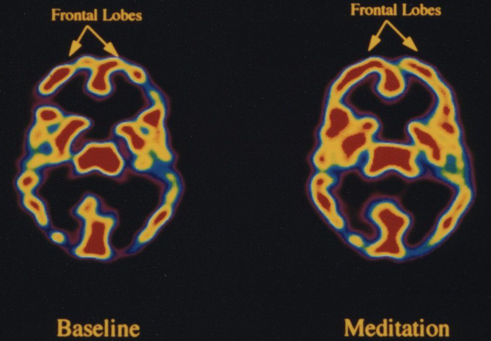 transcendental meditation