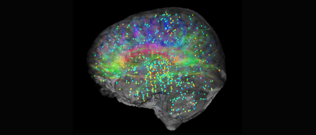 Neuroplasticity - brain map