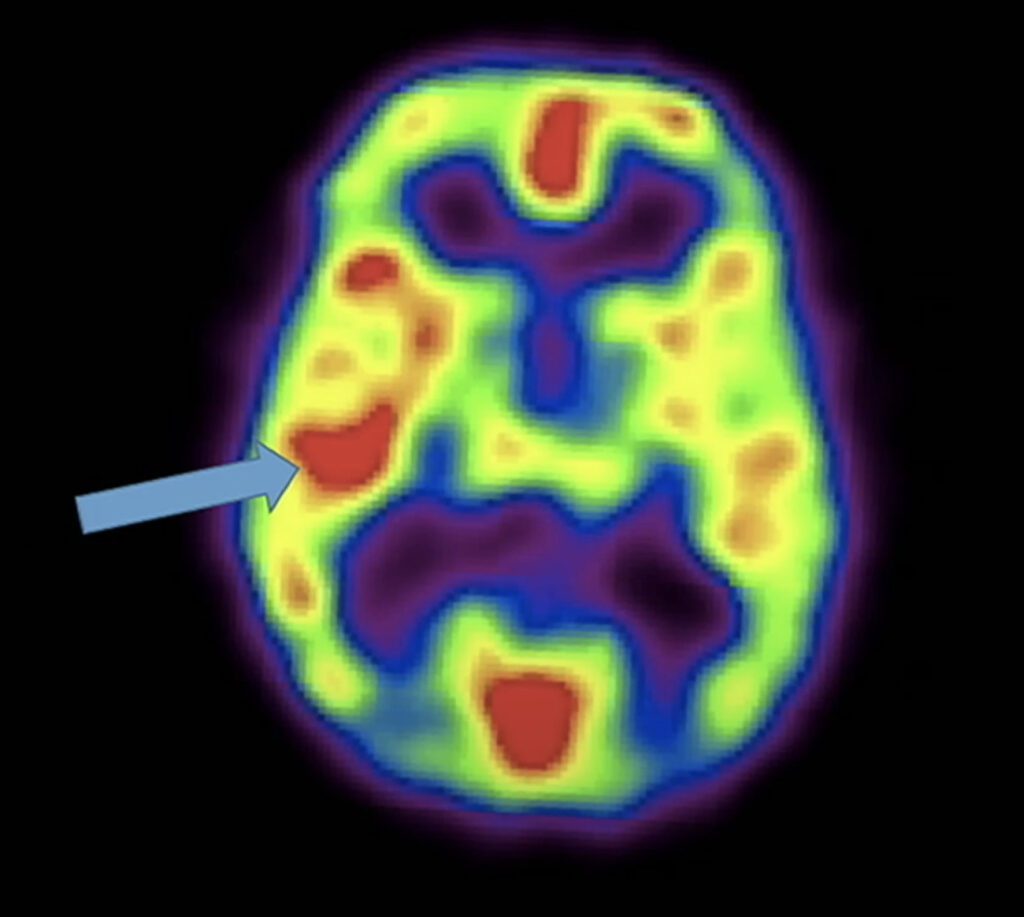 limbic system during enlightenment