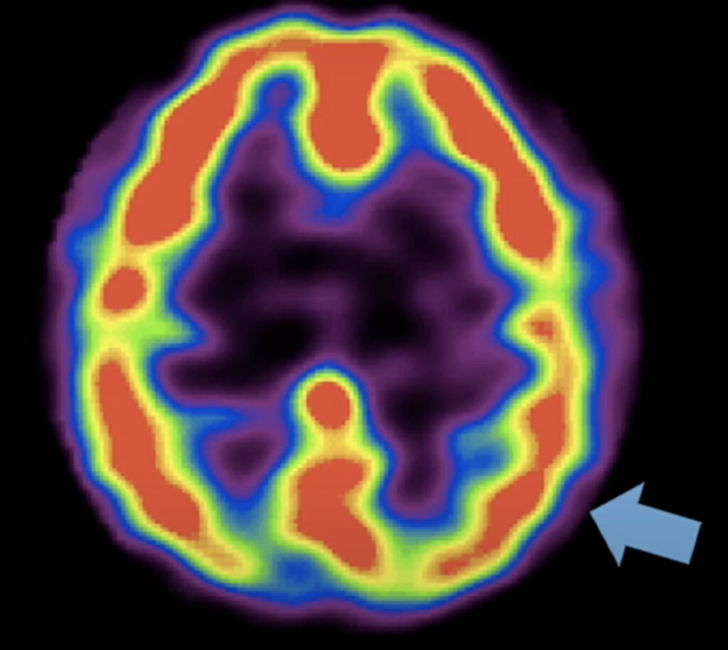 what does your parietal lobe control