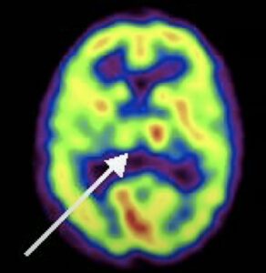 role of thalamus