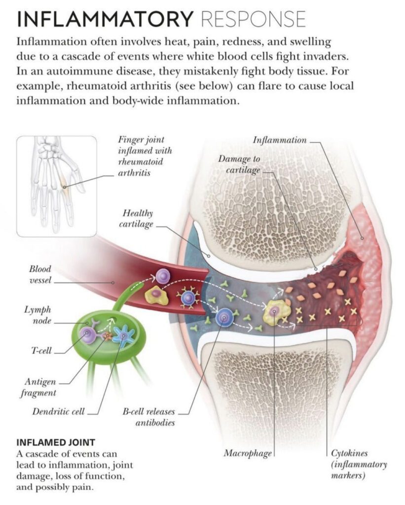 can yoga reduce inflammation